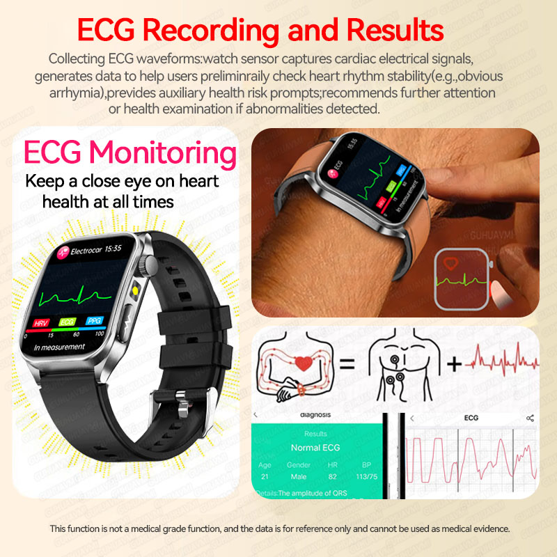 2026 New Non-Invasive Laser Tr - Jewels On Watches review and price